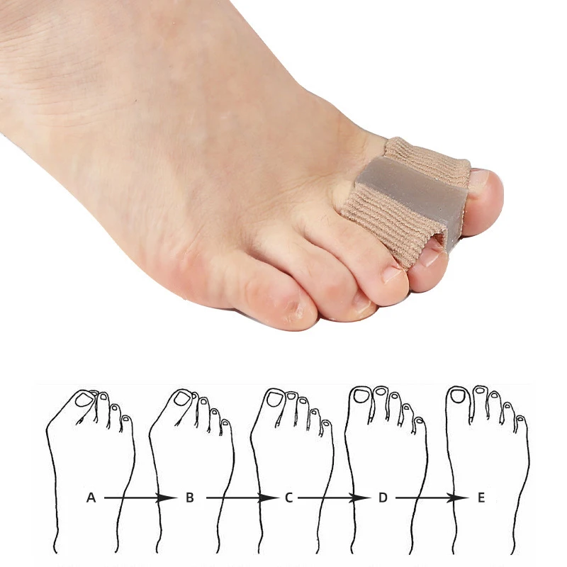 Nieuwe teen-spreider hallux va - Toe Separator Silicon recensie en prijs